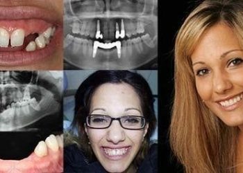 Cosmetic-Dentist