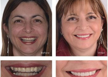 Cosmetic-Dentistry