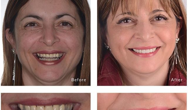 Cosmetic-Dentistry