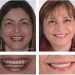 Cosmetic-Dentistry