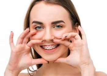Gapped-Teeth