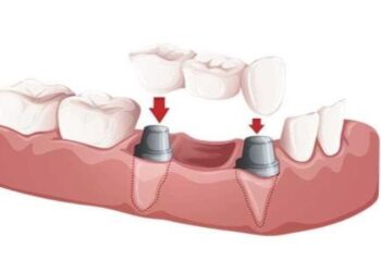 Cosmetic-Dentistry