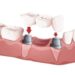 Cosmetic-Dentistry