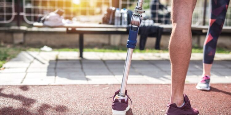 Prosthetic-Leg