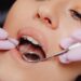 Healthy-Mouth