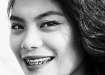 Braces