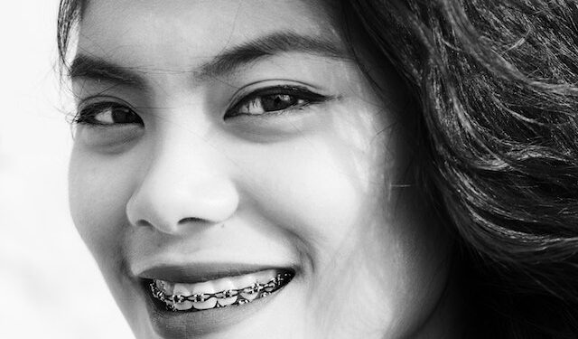 Braces